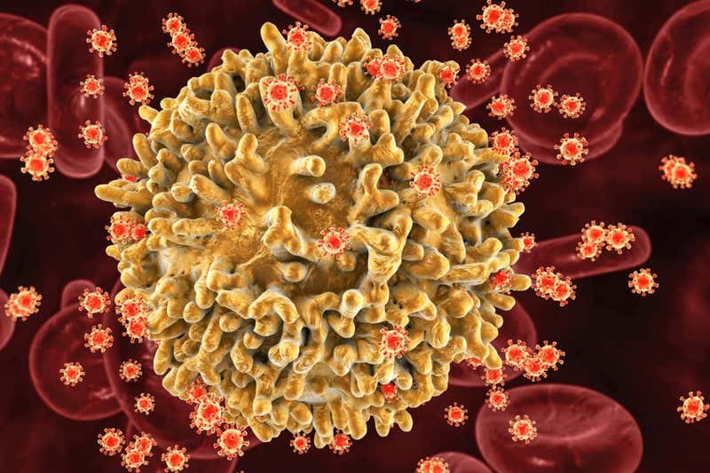 發現毒力更強的HIV新變體